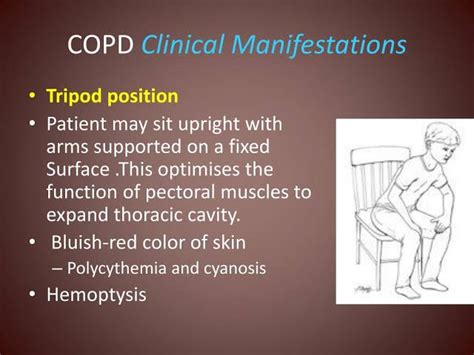 Tripod Position Copd