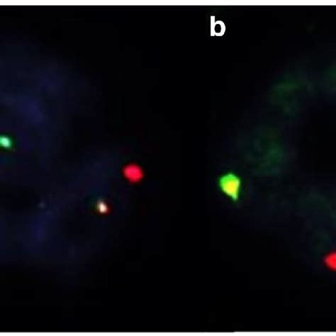 Fluorescence In Situ Hybridization Studies Demonstrating Download