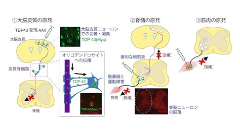 筋萎縮性側索硬化症（als）における異常なたんぱく質の広がり方を解明 －tdp 43による運動神経回路内の病態の進行－ 研究成果・実績