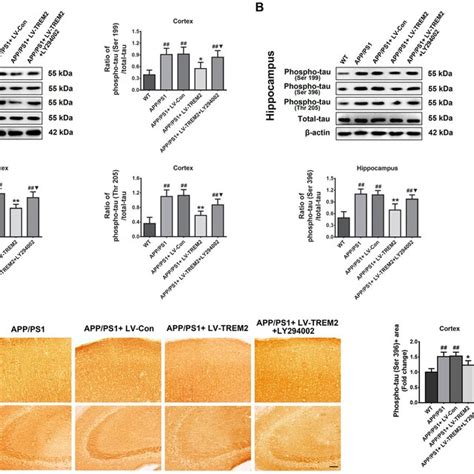 Upregulation Of Trem Inhibits Tau Hyperphosphorylation In App Ps