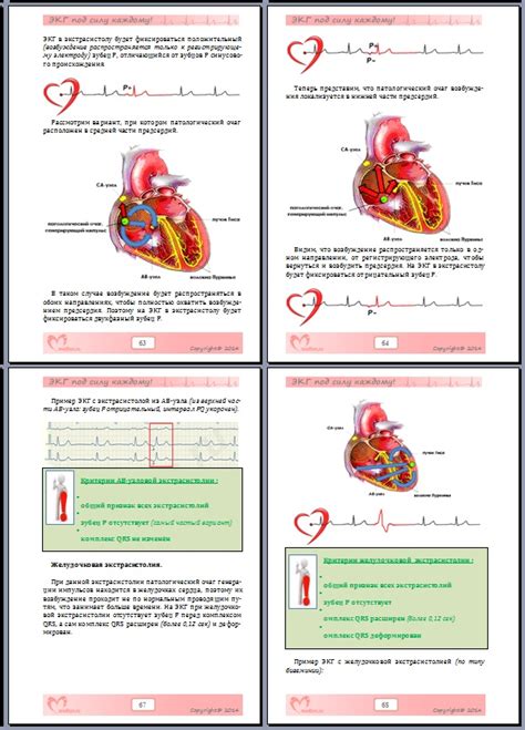 июнь 2025 год: Книга «ЭКГ под силу каждому» + в подарок линейка ЭКГ ...