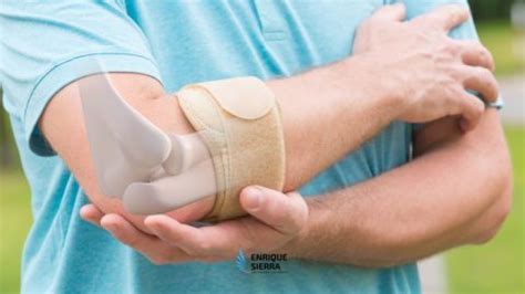 Bursitis De Codo C Mo Se Cura Fisioterapia Sierra