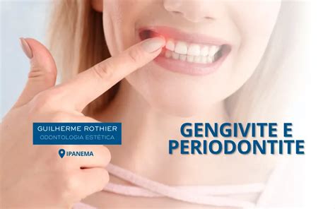 Periodontia em Ipanema dentes e gengiva saudáveis Guilherme Rothier