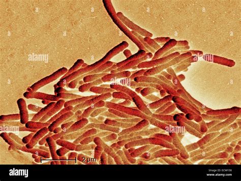 Scanning Electron Micrograph Of Legionella Bacteria Stock Photo Alamy