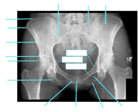 Hip Bone Diagram Quizlet