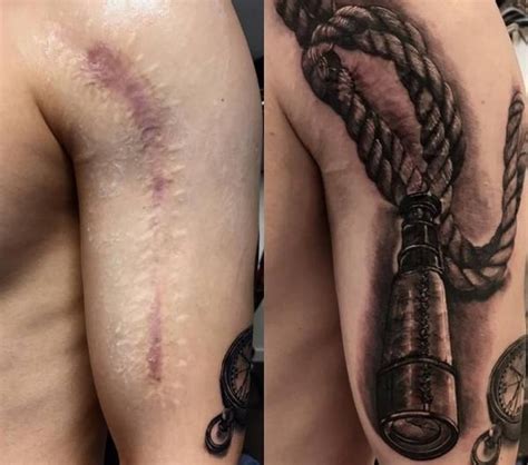 Ideas De Tatuajes Para Tapar Cicatrices En El Cuerpo Tatuajes Con