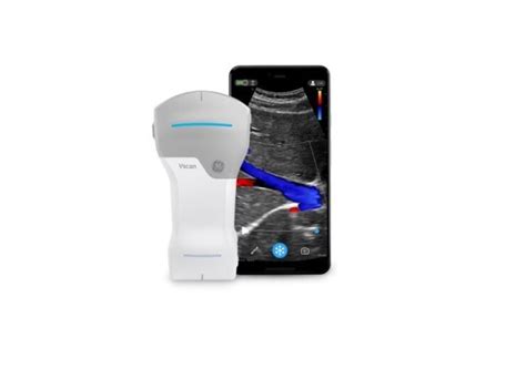 GE Healthcare launches new pocket-sized ultrasound device Vscan Air