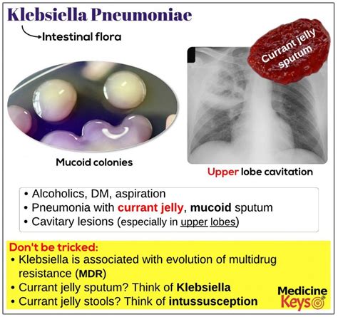 Klebsiella Pneumoniae Medicine Keys For Mrcps