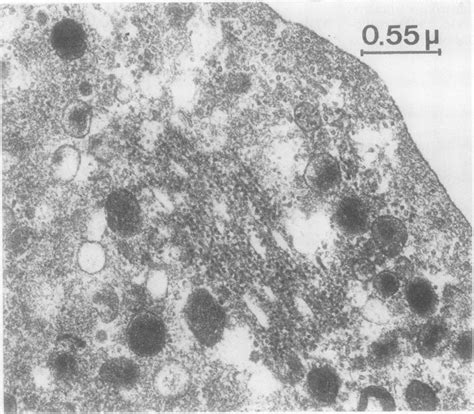 Prokaryotic Cell Electron Micrograph