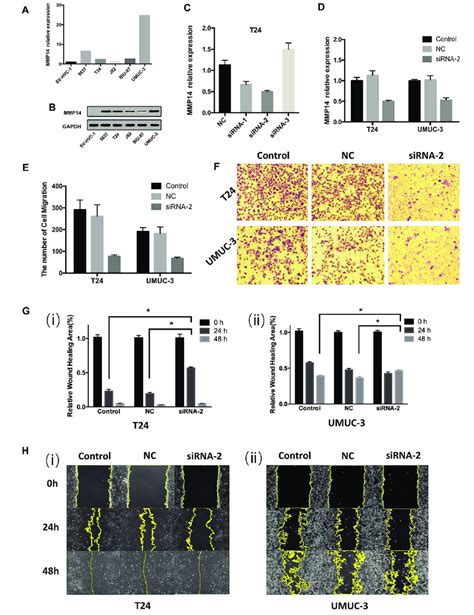 Downregulation Of Mmp Reduced Cell Invasion And Migration Ability In