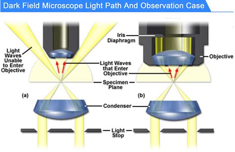 Dark-field Microscopy: Principle And Uses • Microbe, 48% OFF