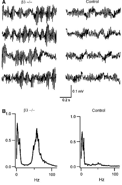 Enhanced LFP gamma activity in the OB of ß3-/-mice. (A) Data shows four ... 
