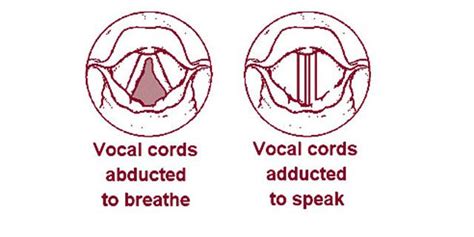 What Is A Vocal Onset