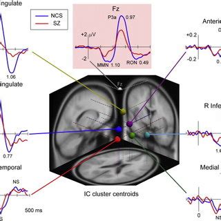 Schematic Of The Eeg Data Processing Pipeline With Sample Results Of