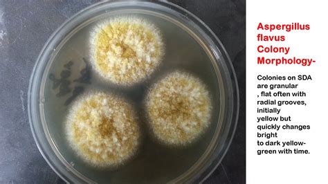 Aspergillus Introduction Classification Colony Morphology Patho