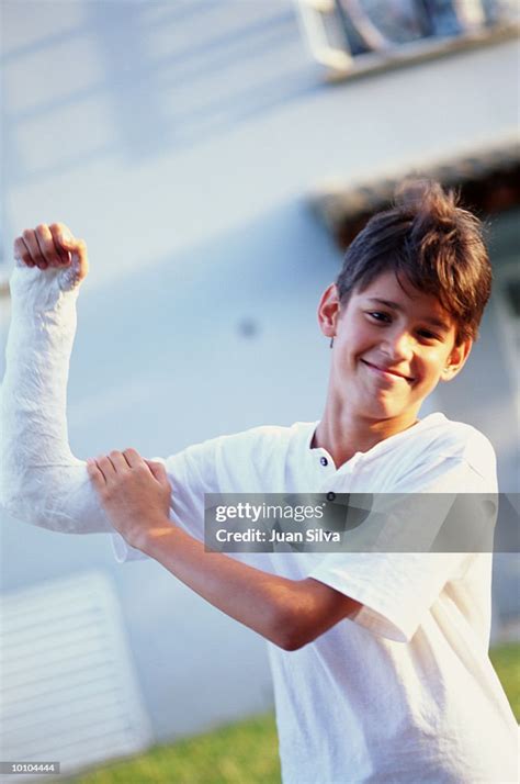 Young Boy With Arm In Cast High Res Stock Photo Getty Images