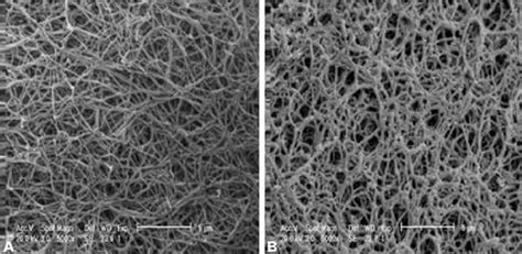 Scanning Electron Microscopy Of Fibrin Clots A Normal Control B Download Scientific