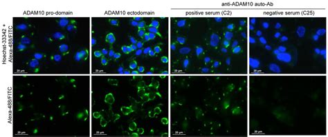 Immunofluorescence Reactivity Of Igg From Patient Sera On Lovo Cell