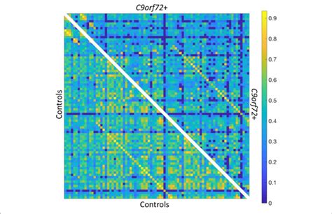 Resting State Functional Connectivity Matrix Thresholded At R