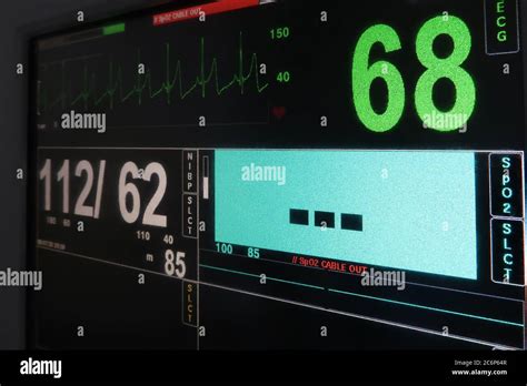 Electrocardiogram Monitor