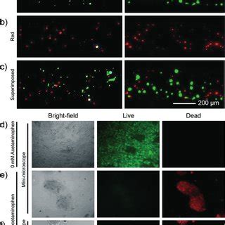 A C Dual Channel Fluorescence Imaging With The Minimicroscope And The