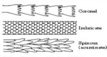 Hair Structure and its role in forensic science - Hair Structure: Cuticle