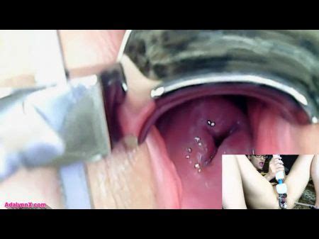 Endoscope Hotntubes Porn