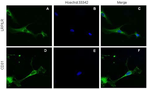 Detection Of Cell Surface Kda Kda Lrp Lr And Cd On Huve Cells By