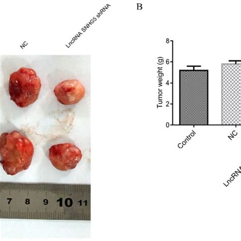 Knockdown Of Snhg Inhibits The Proliferation And Promotes The