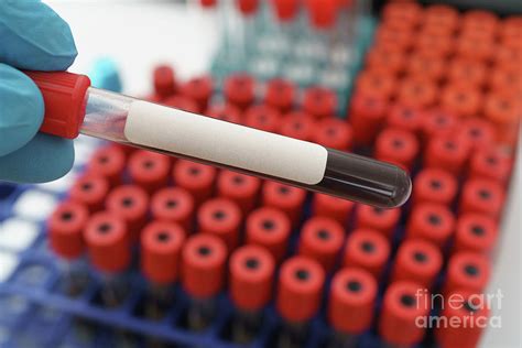 Test Tube With A Blood Sample Photograph By Wladimir Bulgarscience