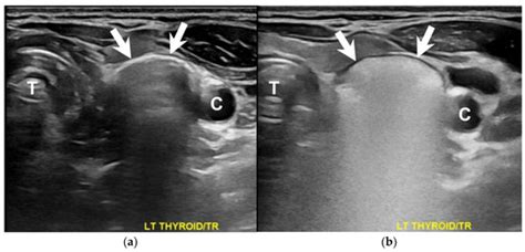 Diagnostics Special Issue Advances In Head And Neck Ultrasound