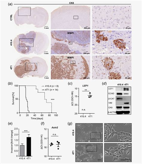 Characterization Of LEF1 Expression In Murine Breast Cancer Cells A