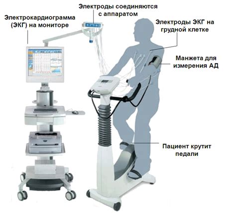 Як проводиться велоергометрія, показання та протипоказання до ...