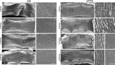 Rapid Endothelialization Of Off The Shelf Small Diameter Silk Vascular