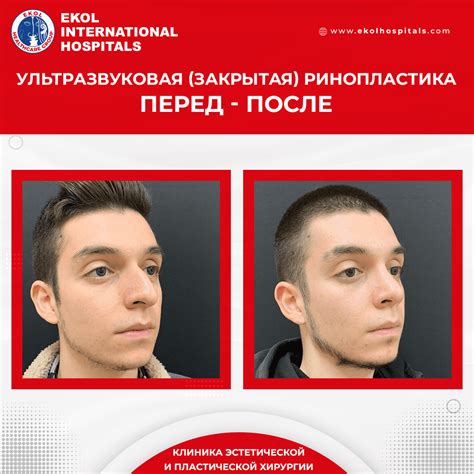 экол больницы