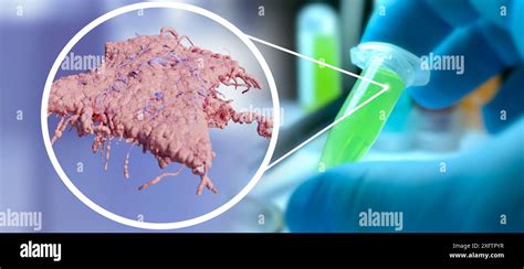 Doctors Hand Infected Lungs Concept Tuberculosis Mycobacterium