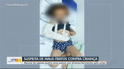 Pai e madrasta são presos suspeitos de espancar criança de 4 anos que