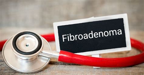 What You Should Know About Non-Cancerous Fibroadenoma - Facty Health