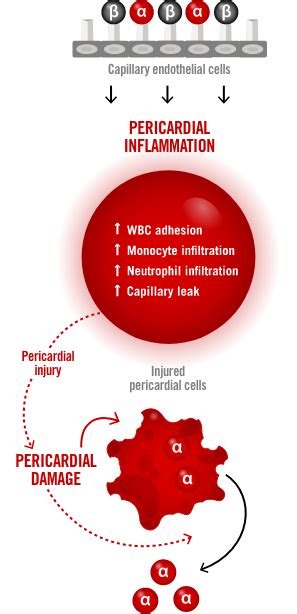 What Causes Recurrent Pericarditis? Underlying Factors