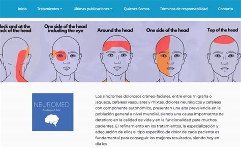 Tratamientos de neuralgia del trigémino disponibles en Santiago Chile