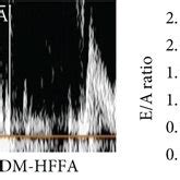 The Influence Of Hg Hffas On Cmecs A The Representative Mitral Flow