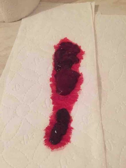 Bleeding While Pregnant