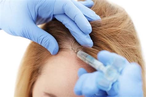 Hair Transplant Be Performed Without Shaving The Head