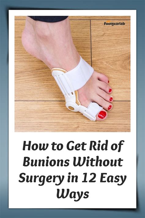 How To Get Rid Of Bunions Without Surgery In 12 Easy Ways In 2021 Get