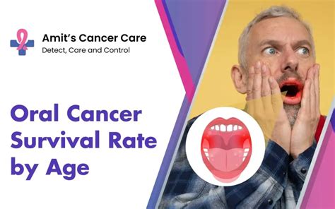 Throat Cancer Survival Rate