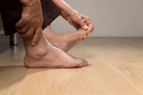 Everything You Need To Know About Gout Blog