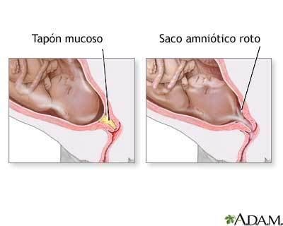 Tapón mucoso en el embarazo qué es y cuándo se produce su expulsión