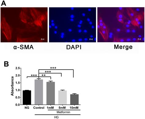 Metformin Inhibits High Glucose Induced Smooth Muscle Cell