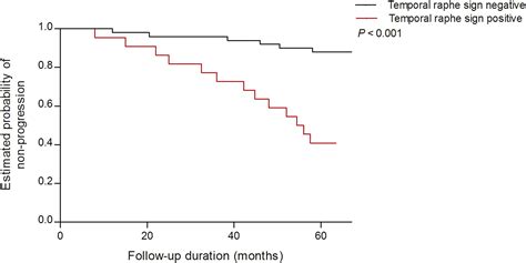 Temporal Raphe Sign In Elderly Patients With Large Optic Disc Cupping