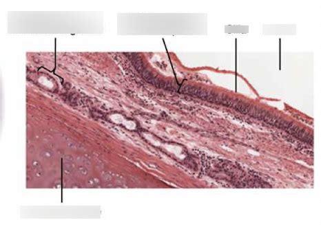 trachea epithelium Diagram | Quizlet